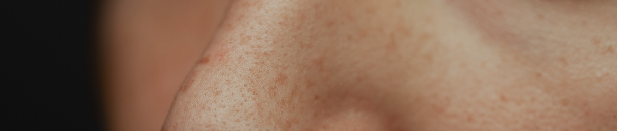 Dark Spot